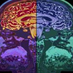 Odlišnú stavbu mozgu a jeho lepšiu výkonnosť u ľudí, ktorí sa pravidelne venujú meditácii znova potvrdil ďalší z mnohých výskumov