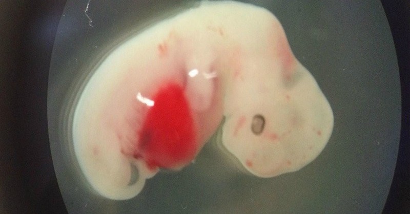 Vedci vložili ľudské bunky do embrya ošípanej, čím sa im podarilo vytvoriť prvý hybrid človeko-prasaťa